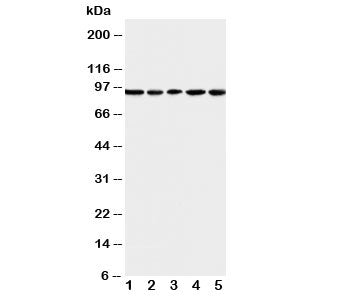 Western blot testing of MCM6 antibody and Lane 1: U87; 2: COLO320; 3: HeLa; 4: MCF-7; 5: Jurkat cell lysate. Expected molecular weight: 92-105 kDa.