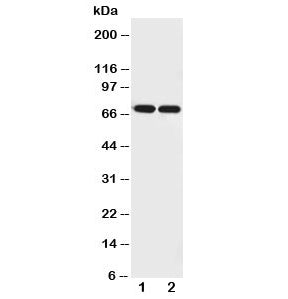 Western blot testing of Netrin 1 antibody and Lane 1: U87; 2: COLO320 cell lysate. Expected molecular weight: 68-75 kDa depending on glycosylation level.