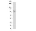 Western blot testing of P2X7 antibody and human U87-MG cell lysate. Expected molecular weight: 65~85 kDa depending on glycosylation level.