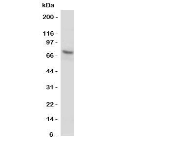 Western blot testing of P2X7 antibody and human U87-MG cell lysate. Expected molecular weight: 65~85 kDa depending on glycosylation level.