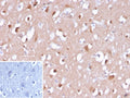 IHC staining of FFPE human brain tissue with Amyloid beta antibody (clone APP/3667). Inset: PBS used in place of primary Ab (secondary Ab negative control). HIER: boil tissue sections in pH 9 10mM Tris with 1mM EDTA for 20 min and allow to cool before testing.