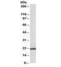 Western blot testing of human pancreas lysate with TMEM205 antibody at 0.03ug/ml. Predicted molecular weight: ~21kDa.