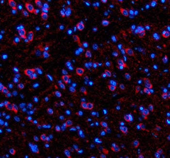 Immunofluorescent staining of SIK2 using anti-SIK2 antibody (red). SIK2 was detected in a paraffin-embedded section of rat brain tissue. Heat mediated antigen retrieval was performed in EDTA buffer (pH 8.0, epitope retrieval solution). The tissue section was blocked with 10% goat serum. The tissue section was then incubated with 5 ug/ml rabbit anti-SIK2 antibody overnight at 4oC. Cy3 Conjugated Goat Anti-Rabbit IgG was used as secondary antibody at 1:500 dilution and incubated for 30 min at 37oC.