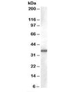 Western blot testing of A549 cell lysate with AKR1B10 antibody at 0.03ug/ml. Predicted molecular weight: ~36kDa.
