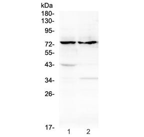Western blot testing of rat 1) thymus and 2) stomach tissue lysate with ADAM10 antibody at 0.5ug/ml. Predicted molecular weight: ~84 kDa (full length), ~60 kDa (active form), ~80 kDa (glycosylated active form), ~110 kDa (glycosylated full length).