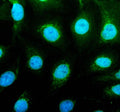 IF analysis of UBE4B using anti-UBE4B antibody (green). UBE4B was detected in an immunocytochemical section of Hela cells. Enzyme antigen retrieval was performed using IHC enzyme antigen retrieval reagent for 15 mins. The cells were blocked with 10% goat serum. And then incubated with 5 ug/ml rabbit anti-UBE4B antibody overnight at 4oC. DyLight 488 Conjugated Goat Anti-Rabbit IgG was used as secondary antibody at 1:500 dilution and incubated for 30 min at 37oC.
