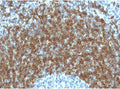 IHC testing of FFPE human tonsil tissue with CD79b antibody (clone CDLA79b-1). HIER: boil tissue sections in pH6, 10mM citrate buffer, for 10-20 min followed by cooling at RT for 20 min.
