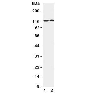 Western blot testing of human 1) HeLa and 2) COLO320 cell lysate with HDAC5 antibody. Predicted molecular weight ~122 kDa, observed at 122-160 kDa.
