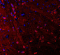 Immunofluorescent staining of FFPE rat brain tissue with PSD-95 antibody (red) and DAPI nuclear stain (blue). HIER: steam section in pH6 citrate buffer for 20 min.
