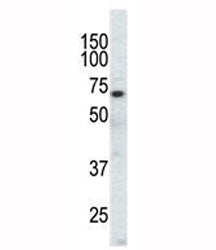 Western blot analysis of EphA3 antibody and CHO cell lysate. Predicted molecular weight: 110/61 kDa (isoforms 1/2).