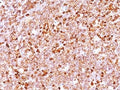 IHC testing of FFPE human tonsil with recombinant CD79a antibody (clone IGA/1688R). Required HIER: boil tissue sections in pH 9 10mM Tris with 1mM EDTA, for 10-20 min followed by cooling at RT for 20 min.