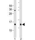Western blot testing of 1) mouse heart and 2) rat spleen lysate with YPEL3 antibody at 1:2000. Predicted molecular weight: 14 kDa.