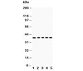 Western blot testing of Fas antibody and Lane 1: HeLa; 2: Jurkat; 3: A549; 4: SMMC-7721; 5: K562 lysate. Predicted molecular weight: ~38 kDa (unmodified), 40-55 kDa (glycosylated).