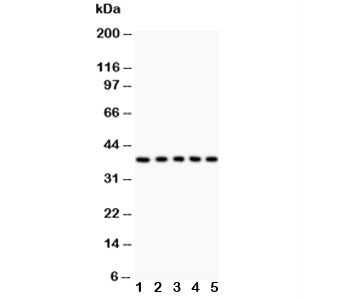 Western blot testing of Fas antibody and Lane 1: HeLa; 2: Jurkat; 3: A549; 4: SMMC-7721; 5: K562 lysate. Predicted molecular weight: ~38 kDa (unmodified), 40-55 kDa (glycosylated).