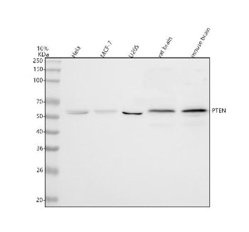 Western blot analysis of PTEN using anti-PTEN antibody. Lane 1: human Hela whole cell lysates, Lane 2: human MCF-7 whole cell lysates, Lane 3: human U20S whole cell lysates, Lane 4: rat brain tissue lysates, Lane 5: mouse brain tissue lysates. After electrophoresis, proteins were transferred to a nitrocellulose membrane at 150 mA for 50-90 min. Blocked the membrane with 5% non-fat milk/TBS for 1.5 hour at RT.