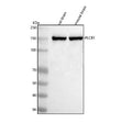 Western blot analysis of PLCB1 using anti-PLCB1 antibody. Lane 1: rat brain tissue lysates, Lane 2: mouse brain tissue lysates. After electrophoresis, proteins were transferred to a nitrocellulose membrane at 150 mA for 50-90 min. Blocked the membrane with 5% non-fat milk/TBS for 1.5 hour at RT.