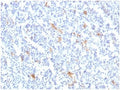 IHC staining of FFPE human tonsil tissue with SPARC antibody (clone OSTN/3759). HIER: boil tissue sections in pH 9 10mM Tris with 1mM EDTA for 20 min and allow to cool before testing.