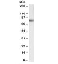 Western blot testing of human adrenal gland lysate with SRB1 antibody at 0.03ug/ml. Predicted molecular weight: ~57/82kDa (unmodified/glycosylated).