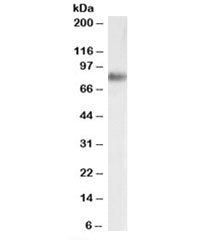 Western blot testing of human adrenal gland lysate with SRB1 antibody at 0.03ug/ml. Predicted molecular weight: ~57/82kDa (unmodified/glycosylated).