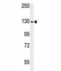 Western blot analysis of IGF1R antibody and WiDr lysate. Predicted molecular weight: ~200 kDa (pro), 120-130 kDa (alpha), 90-97 kDa (beta).