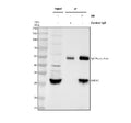 Immunoprecipitating IMPA1 in Jurkat whole cell lysate. Western blot analysis of IMPA1 using anti-IMPA1 antibody. Lane 1: Jurkat whole cell lysates (30ug), Lane 2: Rabbit control IgG instead of anti-IMPA1 antibody in Jurkat whole cell lysate, Lane 3: anti-IMPA1 antibody (2ug) + Jurkat whole cell lysate (500ug). After electrophoresis, proteins were transferred to a membrane.
