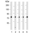 Western blot testing of human 1) MCF7, 2) HeLa, 3) SH-SY5Y, 4) Jurkat and 5) HL60 cell lysate with KIF22 antibody. Predicted molecular weight ~73 kDa.