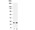 Western blot testing of Ly6AL antibody and Lane 1: rat heart; 2: rat liver tissue lysate. Predicted molecular weight ~16 kDa.