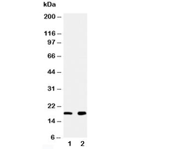 Western blot testing of Ly6AL antibody and Lane 1: rat heart; 2: rat liver tissue lysate. Predicted molecular weight ~16 kDa.