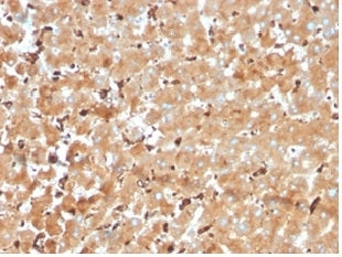 IHC staining of FFPE human liver tissue with Haptoglobin antibody (clone HP/3840) at 2ug/ml. HIER: boil tissue sections in pH 9 10mM Tris with 1mM EDTA for 20 min and allow to cool before testing.