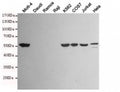 Western blot testing of Vimentin-positive cell lines (Molt-4, K562, COS7, Jurkat, HeLa) and Vimentin-negative cell lines (Daudi, Ramos, Raji) using Vimentin antibody at 1:1000. Predicted molecular weight ~58 kDa.