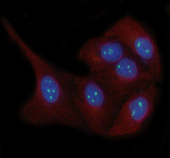 Immunofluorescent staining of LYAR using anti-LYAR antibody (green) and anti-Beta Tubulin antibody (red). LYAR was detected in immunocytochemical section of human HeLa cells. Enzyme antigen retrieval was performed using IHC enzyme antigen retrieval reagent for 15 mins. The cells were blocked with 10% goat serum. And then incubated with 5 ug/ml rabbit anti-LYAR antibody and mouse anti-Beta Tubulin antibody overnight at 4oC.