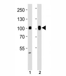 Western blot analysis of lysate from human (1) HeLa and (2) Ramos cell line using SP1 antibody at 1:1000. Reported molecular weight: 81-95 kDa.