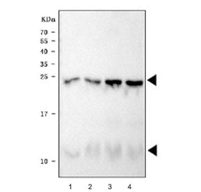 Western blot testing of 1) rat heart, 2) rat heart, 3) mouse heart and 4) mouse heart tissue lysate with Phospholamban antibody. Predicted molecular weight: 6/12/18/24 kDa (monomer/dimer/oligomers).