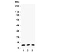 Western blot testing of Eotaxin antibody (0.5ug/ml) and Lane 1: mouse lung; 2: (m) intestine; 3: (m) HEPA lysate
