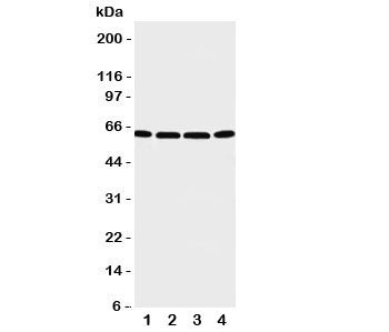 Western blot testing of P2X6 antibody and Lane 1: U87; 2: 22RV1; 3: Jurkat; 4: HT1080 cell lysate. Expected/observed size 49~70KD depending on glycosylation level