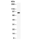 Western blot testing of human SMMC cell lysate with SMURF2 antibody. Expected/observed molecular weight ~86 kDa.
