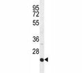 ICAM2 antibody western blot analysis in HepG2 lysate. Expected molecular weight: 31-60 kDa depending on glycosylation level.