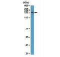 Western blot testing of human T-cell lysate with recombinant CPS1 antibody at 1:10,000 dilution. Predicted molecular weight ~165 kDa.