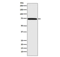Western blot testing of human 293T cell lysate with Menin antibody. Predicted molecular weight ~68 kDa.