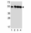 Western blot analysis of TUBB2C antibody and (1) HeLa, (2) MDA-MB435, (3) MDA-MB231, and (4) HepG2 lysate.