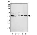 Western blot testing of human 1) HeLa, 2) 293T, 3) Caco-2, 4) ThP-1 and 5) HepG2 cell lysate with HEXA antibody. Expected molecular weight: ~60 kDa (precursor), ~54 kDa (mature).