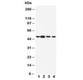 Western blot testing of Dopamine Receptor D3 antibody and Lane 1: rat testis; 2: rat brain; 3: human U-87 MG; 4: human HeLa cell lysate. Predicted molecular weight ~44 kDa.