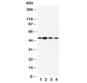 Western blot testing of Dopamine Receptor D3 antibody and Lane 1: rat testis; 2: rat brain; 3: human U-87 MG; 4: human HeLa cell lysate. Predicted molecular weight ~44 kDa.