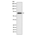 Western blot testing of rat L6 cell lysate with MMP2 antibody. Expected molecular weight: ~72 kDa (pro form), ~63 kDa (cleaved form).
