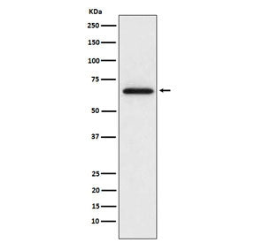 Western blot testing of rat L6 cell lysate with MMP2 antibody. Expected molecular weight: ~72 kDa (pro form), ~63 kDa (cleaved form).