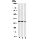 Western blot testing of heart [A], skeletal muscle [B] and kidney [C] lysates with LDHA antibody at 0.3ug/ml. Predicted molecular weight ~36kDa.
