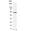 Western blot testing of CDC6 antibody and Lane 1: Jurkat; 2: MCF-7 cell lysate. Predicted/observed molecular weight: ~62kDa