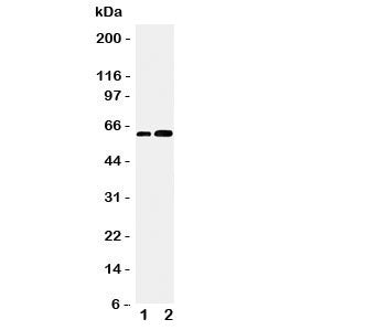 Western blot testing of CDC6 antibody and Lane 1: Jurkat; 2: MCF-7 cell lysate. Predicted/observed molecular weight: ~62kDa