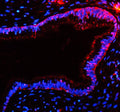 Immunofluorescent staining of TAS2R10 using anti-TAS2R10 antibody (red). TAS2R10 was detected in a paraffin-embedded section of human cervix cancer tissue. Heat mediated antigen retrieval was performed in EDTA buffer (pH 8.0, epitope retrieval solution). The tissue section was blocked with 10% goat serum. The tissue section was then incubated with 5 ug/ml rabbit anti-TAS2R10 antibody overnight at 4oC.