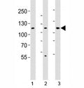 Western blot analysis of lysate from 1) HT-29, 2) HeLa, and 3) Jurkat cell line using JAK1 antibody; Ab was diluted at 1:1000.